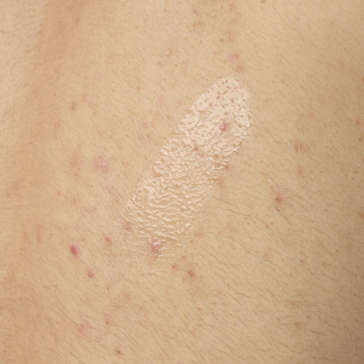 salicylic-acid-0-5-body-serum-d4 ORD-salicylic-acid-05-body-240ml-application.jpg