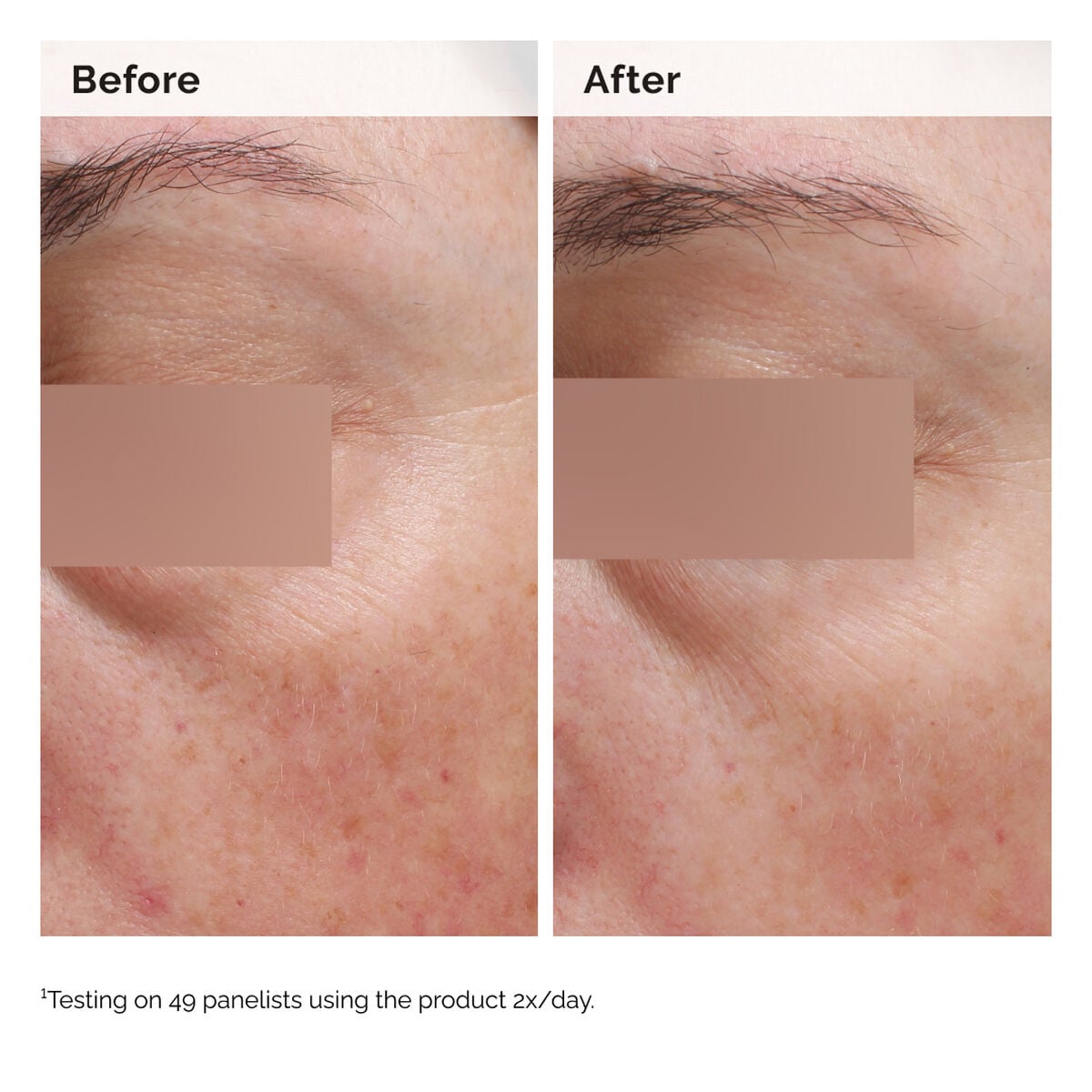 niacinamide-5-face-and-body-emulsion-n6 2024-08-23-ORD-Nia-5pct-Face-Body-B-A-Elasticity-Global-02-1x1.jpg