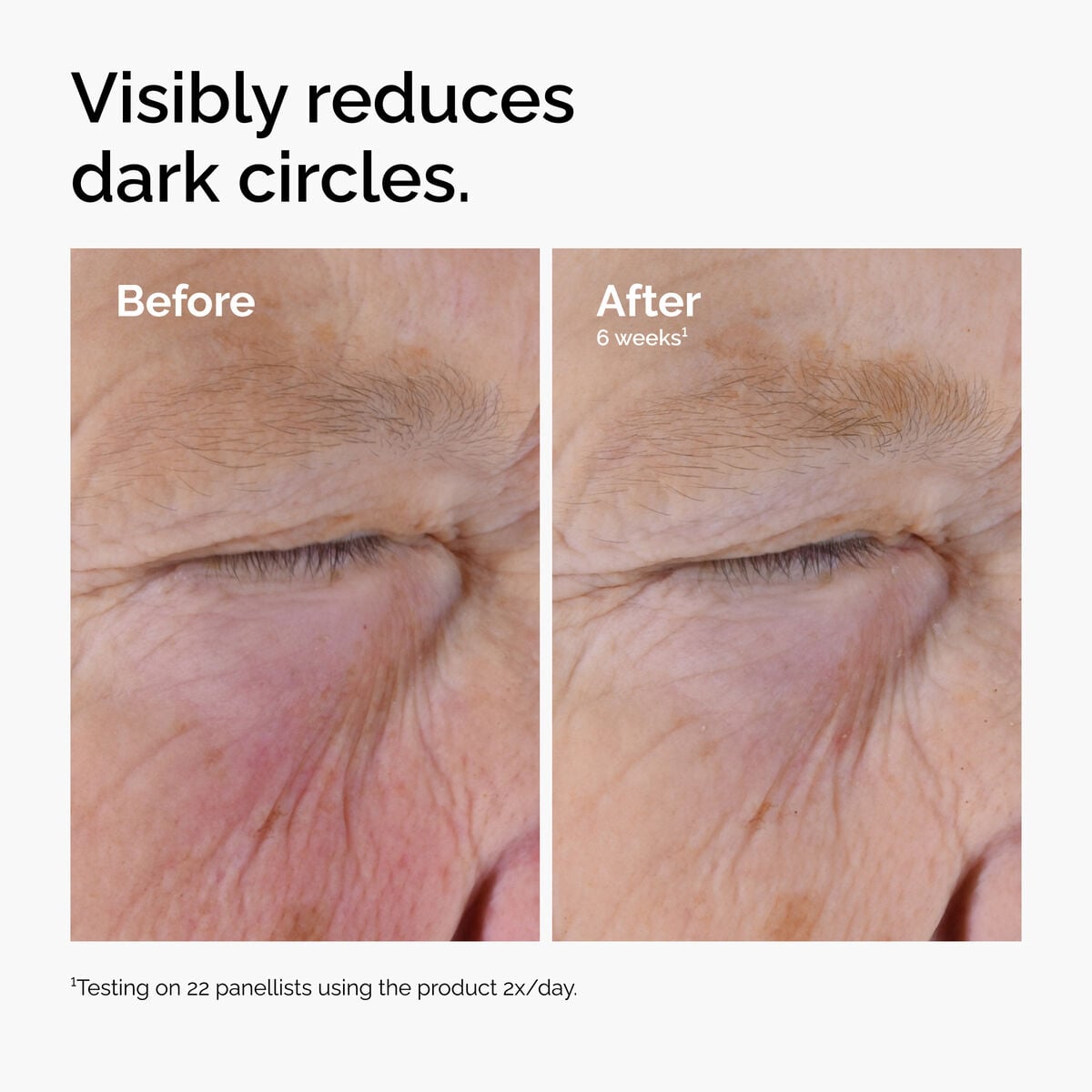 caffeine-solution-5-egcg-eye-serum-d4 ord-caffeine-solution-egcg-dark-circles-before-after.jpg