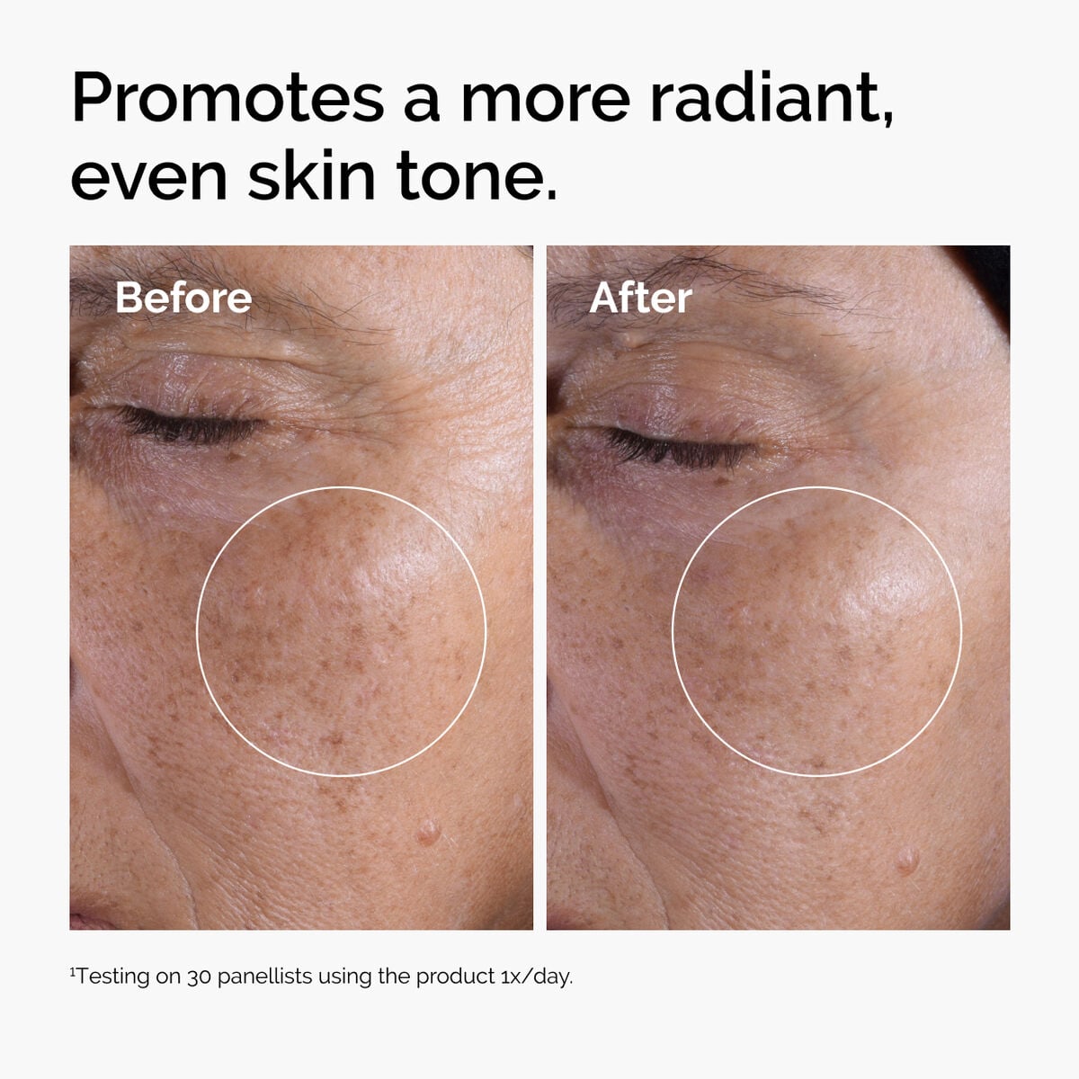 glycolic-acid-7-exfoliating-toner-y0 ord-glycolic-before-after-radiance.jpg