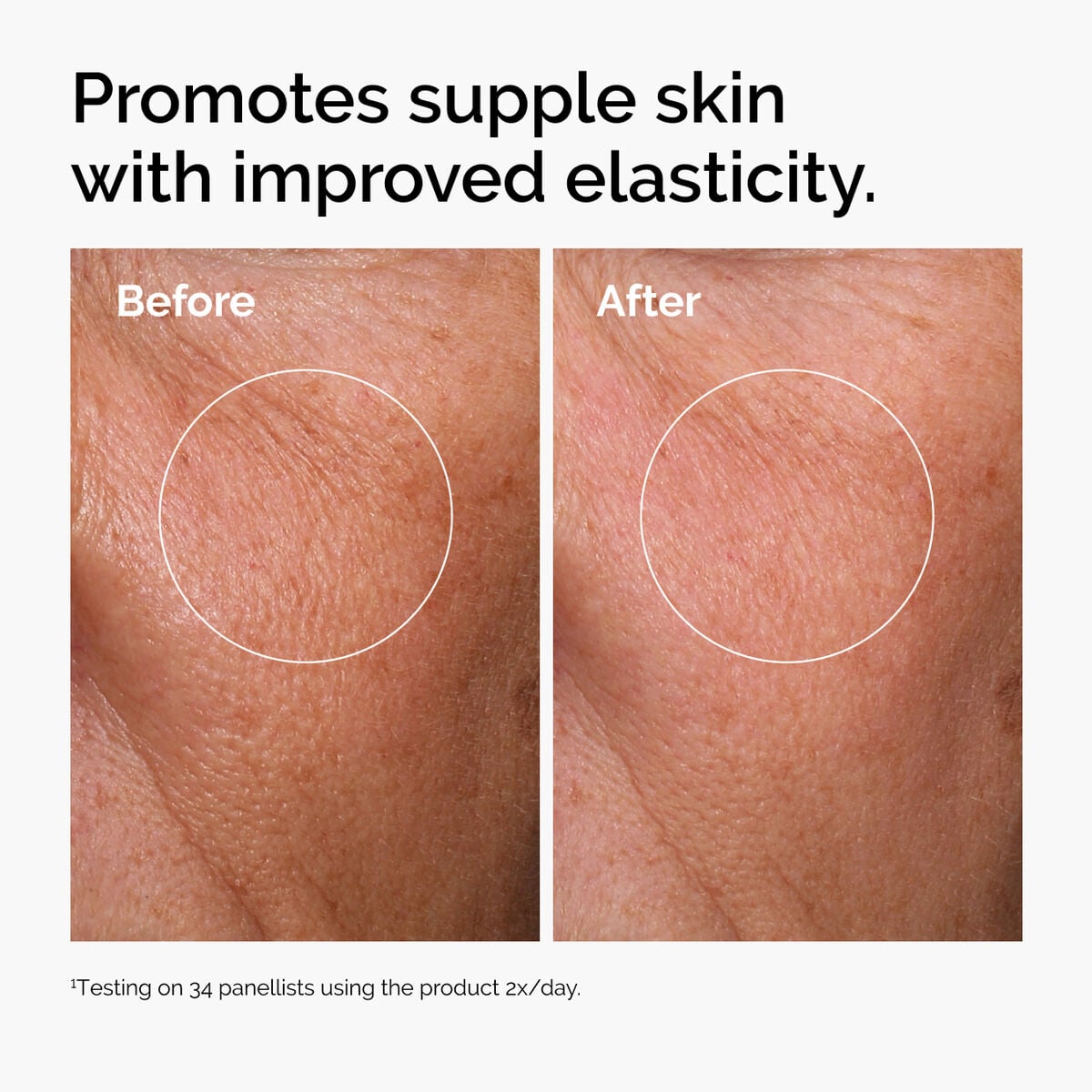 hyaluronic-acid-2-b5-with-ceramides-a2 ord-hyaluronic-acid-2pct-b5-hydrating-serum-before-after-elasticity.jpg