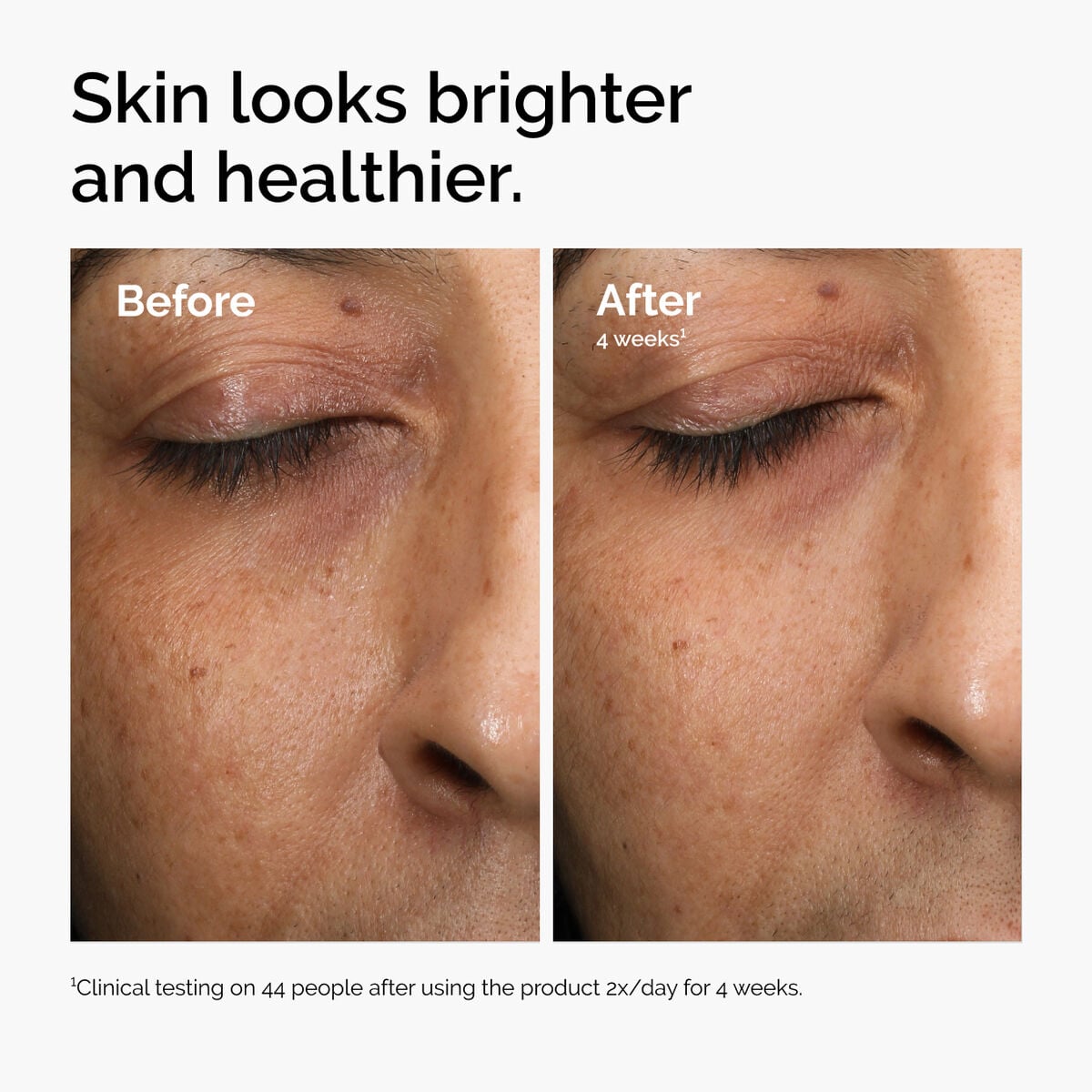multi-antioxidant-radiance-serum-u5 ord-mars-before-after-healthy.jpg