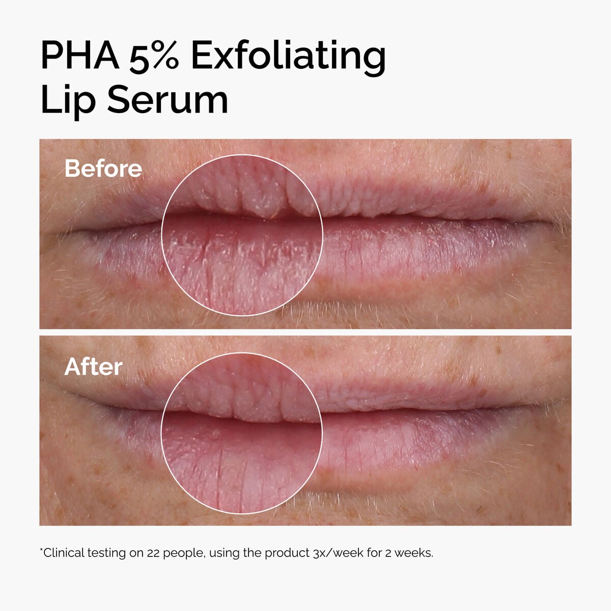pha-5-exfoliating-lip-serum-r2 ord-pha-5pct-lip-exfoliating-serum-before-after.jpg